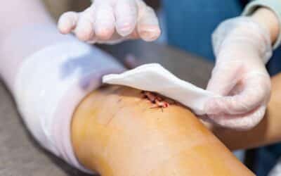 Understanding Different Types of Wounds: A Complete Guide to Wound Classification